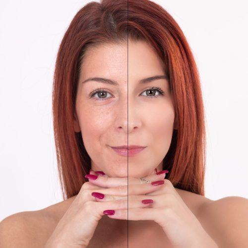 anti aging comparison